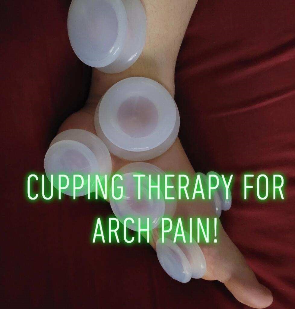 How Cupping Can Help Chronic Muscle Tension & Pain - Lakes